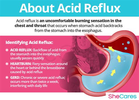 5 Sure reflux myter